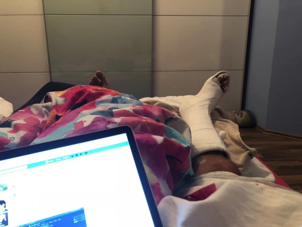 Houston, we have a broken leg! Houston, we have a broken leg!